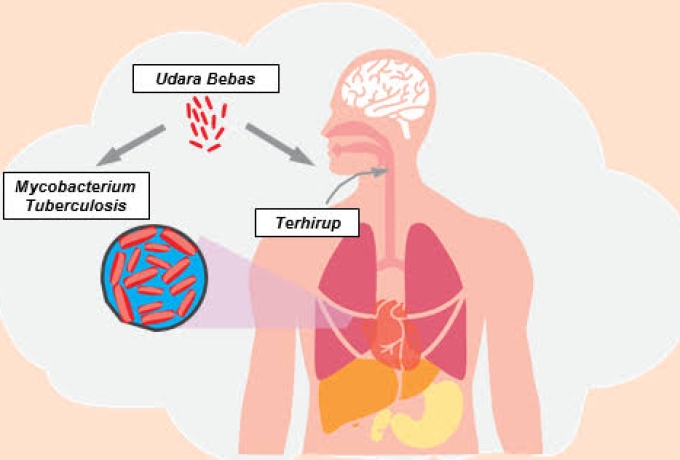 Kadiskes Inhil Jelaskan Tahapan Bagi Pasien Terduga Tuberkulosis